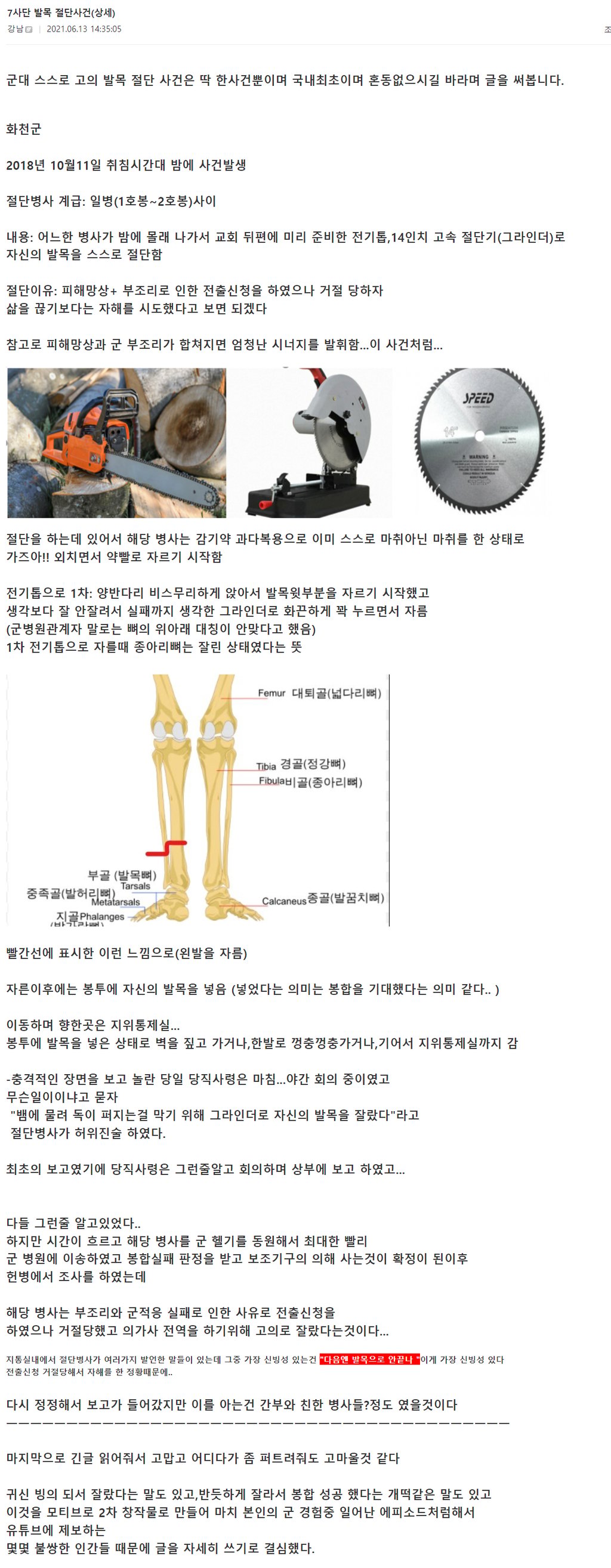 그라인더로 발목을 자르고 지통실까지 가져간 한국 군인 9