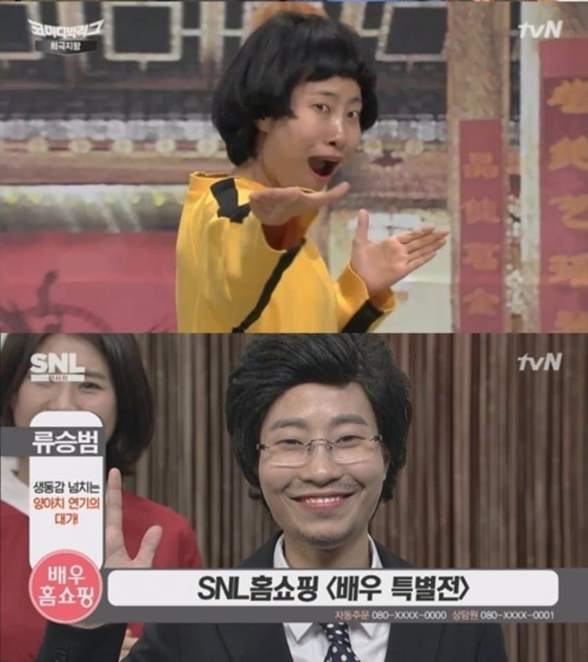 성형에 1억5천쓴 개그우먼 1