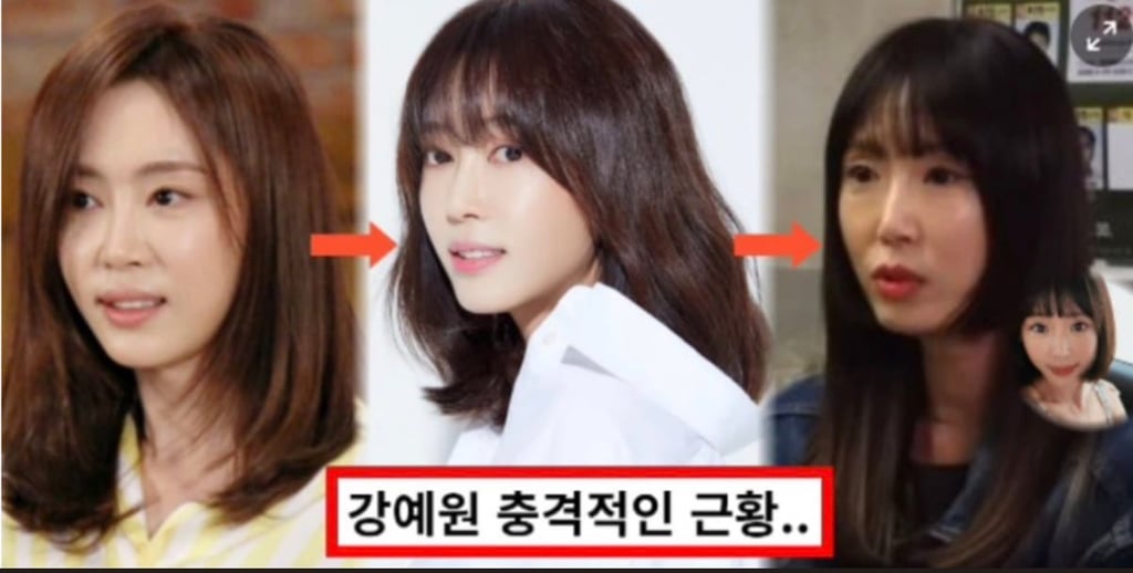 강예원 변천사