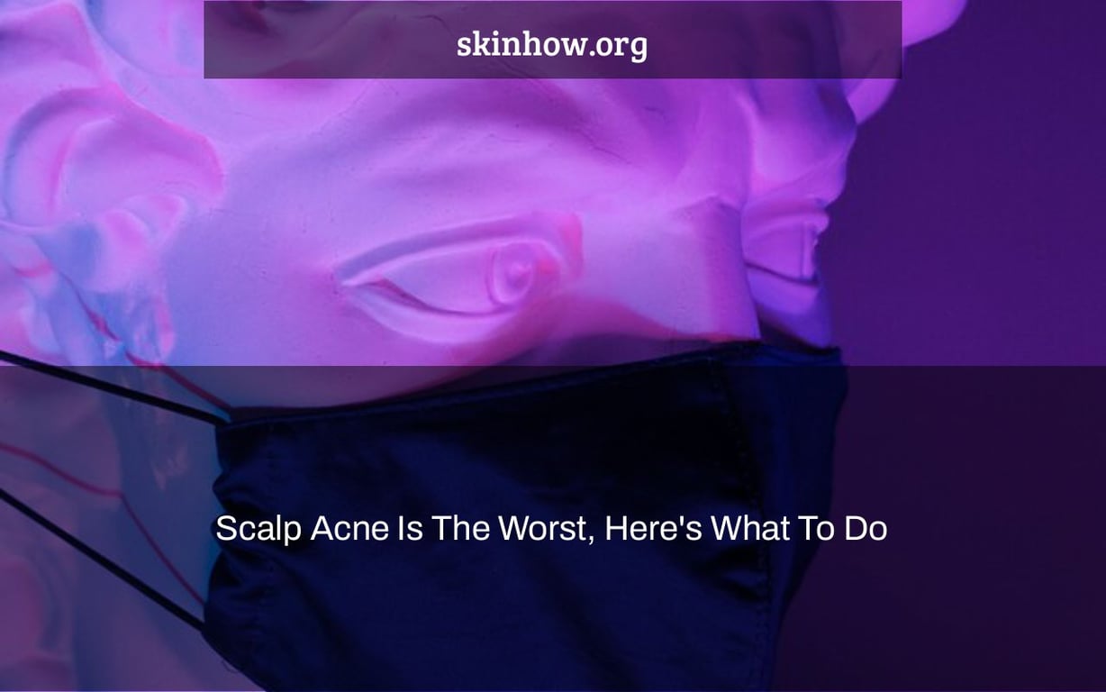 Scalp Acne Is The Worst, Here's What To Do
