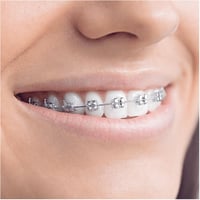 Oral-B Teen elektromos fogkefe, fogszabályzóhoz, Bluetooth-os, fehér 7
