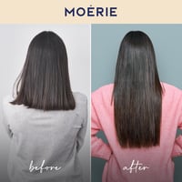 MOERIE Hajnövekedést Serkentő Készlet - 4 részes Hajhullás Ellen, Vegán, 77 Ásvánnyal 7