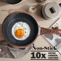 Kitchen Academy 12 részes fekete gránit edénykészlet - Tapadásmentes indukciós fazék és serpenyő szett, PFOA és PFOS mentes, hőálló bakelitf 2