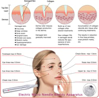 BOWKA 36 tűs univerzális microneedling patron, 10 db, elektromos derma penhez 5