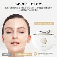ANLAN EMS Gua Sha elektrický masážny prístroj na tvár proti vráskam, modré/fialové/červené svetlo, studená a teplá masáž, 3 úrovne intenzity, bielo-zlatý, stredná veľkosť 2