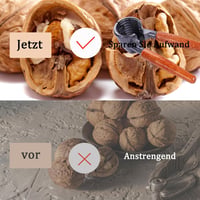 anneratteryer Diós Mogyorós Pähklinyomó Fa Nyéllel 2 Darabos Szett 3