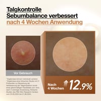 Anua Rice 70 Glow Milky Toner – Hydratačné pleťové tonikum s ryžovou vodou, niacínamidom a ceramidmi, kórejská starostlivosť o pleť, pre všetky typy pleti, bez parfumácie, 250 ml 6