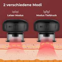 Nuvance 72 fokozatú elektromos köpölyöző szett - Cellulitkezelő masszírozó készülék (fekete) 6