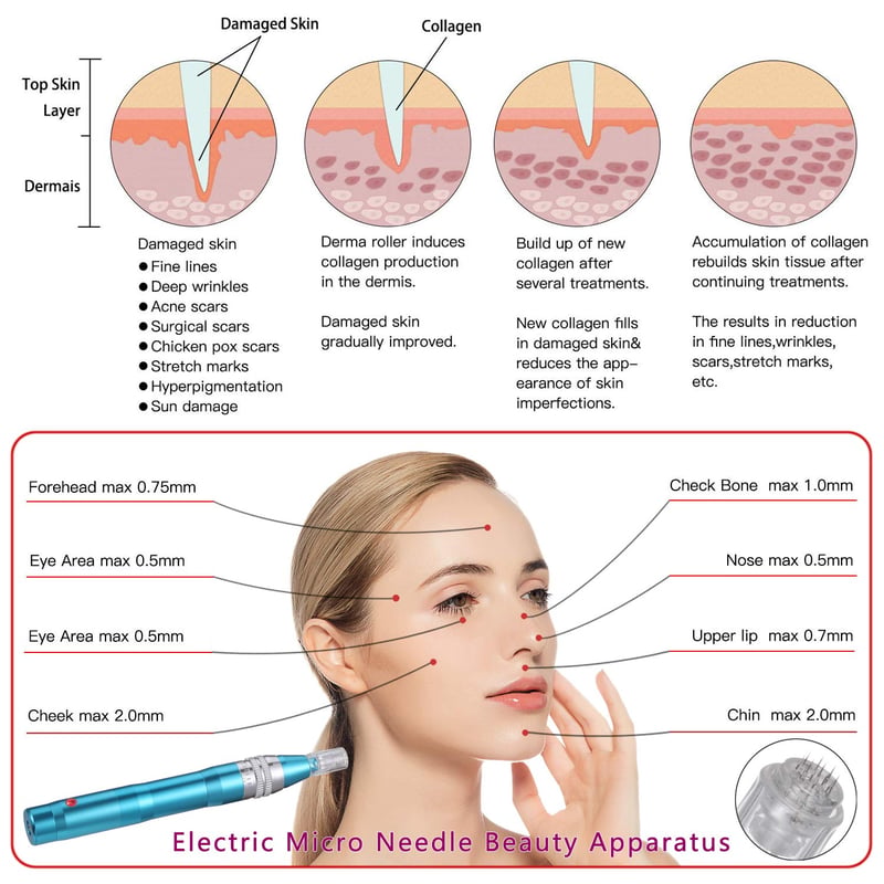 BOWKA Elektromos Derma Pen Mikrotűzéshez Vezeték Nélküli Állítható 0,25-2,5mm Kék Arckezelő Készülék Ránctalanításhoz
