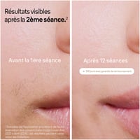 IPL epilátor Braun Silk-expert Pro 5 PL5262, s holiacim strojčekom Venus a 3 nadstavcami – biely/zlatý 5