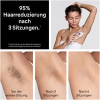 Aparat de epilare IPL Braun Skin i·expert 7 PL7311 – Epilator inteligent cu lumină intens pulsată, auriu-roz 5