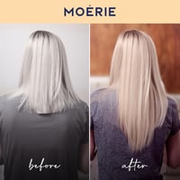 MOERIE Hajnövekedést Serkentő Készlet - 4 részes Hajhullás Ellen, Vegán, 77 Ásvánnyal 6
