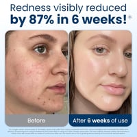 Clean Skin Club XL arctörlő kendő 50db, 100% organikus pamut, dermatológiailag tesztelt arclemosó - Stable - 50 count 3