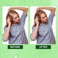 Rozmaring hajolaj 60ml - 100% természetes hajnövesztő és fejbőrápoló olaj 8