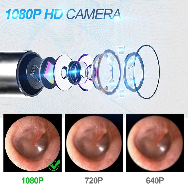 GOLDGE HD 1080P Fülzsír Eltávolító Endoszkóp - iPhone, Android Kompatibilis