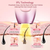 Desing Wish IPL Szőrtelenítő Készülék 5 Energiaszinttel és 2 Móddal 3