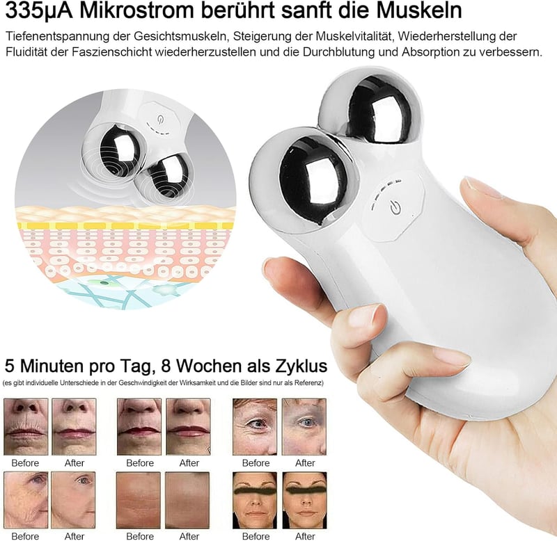 Kyaoayo Mikroáramú Arcmasszírozó - Ránctalanító és Bőrfeszesítő Készülék