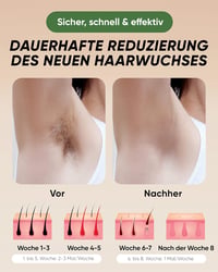 Braun IPL szőrtelenítő készülék 999.999 villanással - Tartós, fájdalommentes használat otthon 4