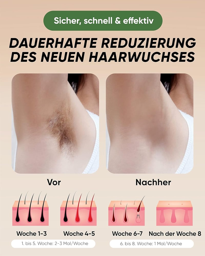 Braun IPL szőrtelenítő készülék 999.999 villanással - Tartós, fájdalommentes használat otthon