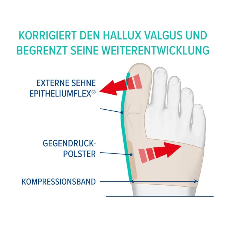 Epitact Hallux Valgus Korrekciós Ortézis L méret - Bunion Támogatás
