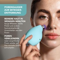 Dispozitiv FOREO KIWI pentru eliminarea coșurilor și a punctelor negre - Curățarea porilor, fără benzi pentru pori, instrument de îngrijire a tenului cu acțiune rapidă 2
