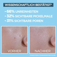 Garnier Invisible Matt SPF 50+ Napvédő Fluid Akné és Pattanások Ellen 40ml 5