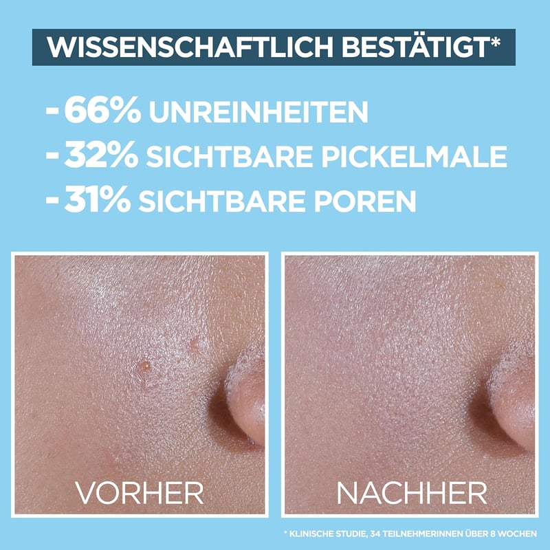Garnier Invisible Matt SPF 50+ Napvédő Fluid Akné és Pattanások Ellen 40ml