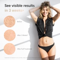 Dispozitiv IPL de epilare Haarlosy pentru femei și bărbați - Epilator profesional cu lumină pulsatilă pentru uz casnic 3