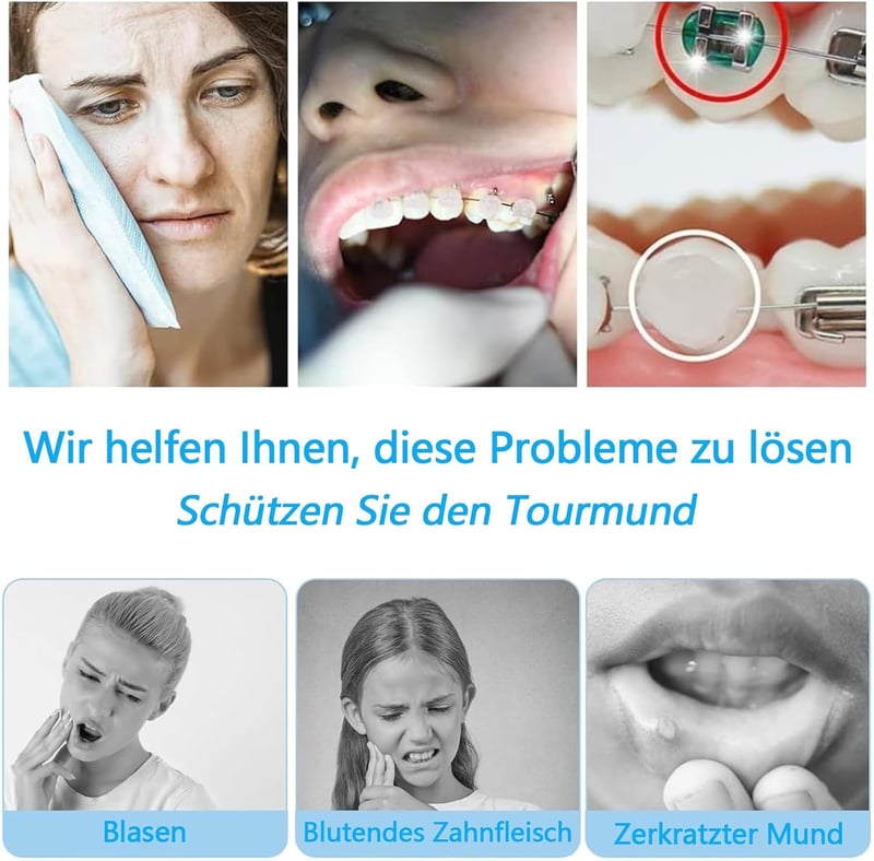HSYTEK 4 doboz fogszabályzó konzol viasz csíkok 20 db, orthodontiai wax a dörzsölés és fájdalom enyhítésére