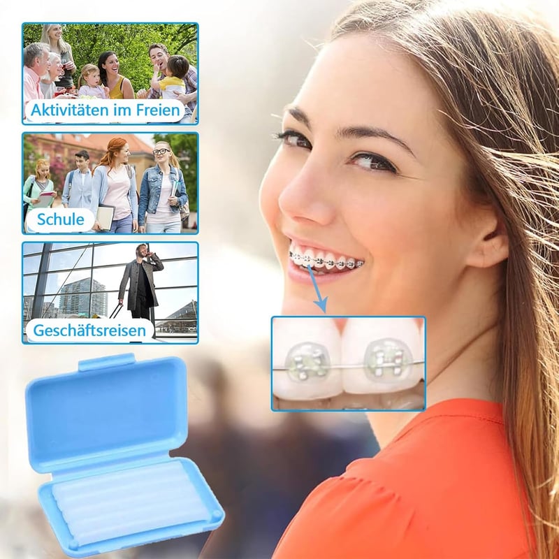 HSYTEK 4 doboz fogszabályzó konzol viasz csíkok 20 db, orthodontiai wax a dörzsölés és fájdalom enyhítésére