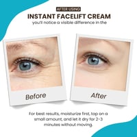 Instantly Ageless Ránctalanító Szérum 25 Ampulla - Azonnali Hatású Bőrfiatalító Kezelés Puffadás Ellen, Minden Bőrtípusra, Rózsa Illattal 4