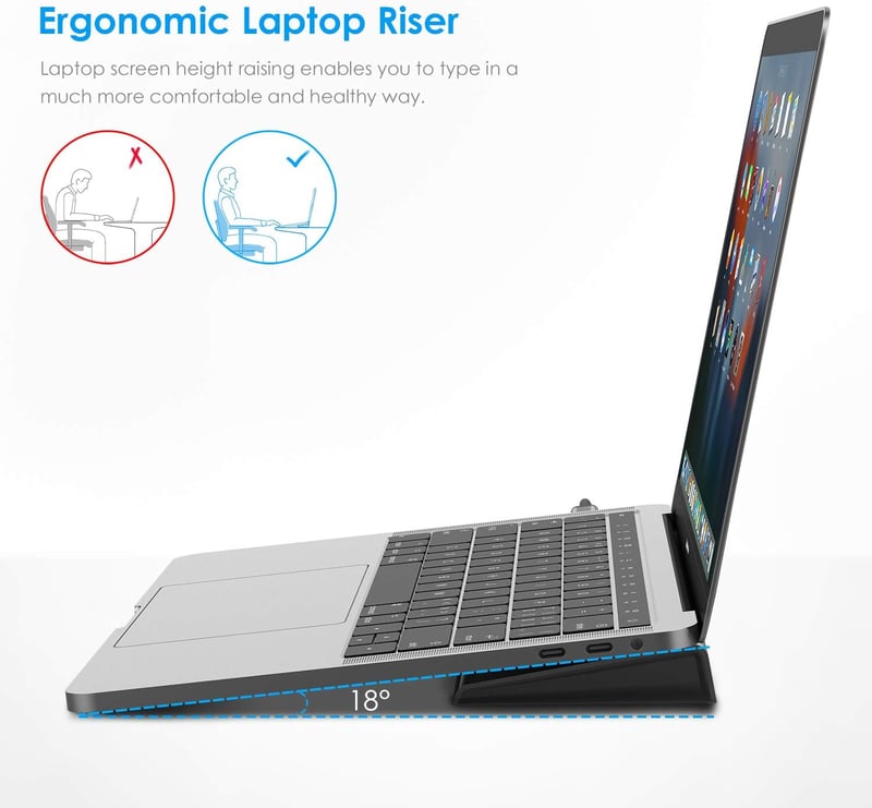 LENTION USB C Hub 4K HDMI, DisplayPort, VGA, 100W PD, Ethernet, Kártyaolvasó - MacBook Pro, Air, iPad Pro, Surface Laptopokhoz (Szürke)