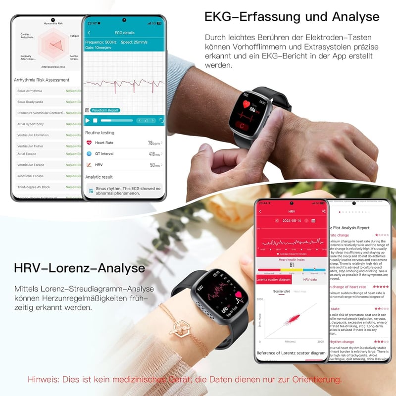 Lgnitek 1.75" HD Smartwatch ECG+HRV, Vérnyomás, Pulzus, SpO2, Hőmérséklet Monitorozás Férfiaknak és Nőknek