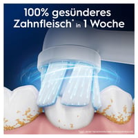 Náhradná hlavica na elektrickú zubnú kefku Oral-B iO Gentle Care biela, 6 ks 3