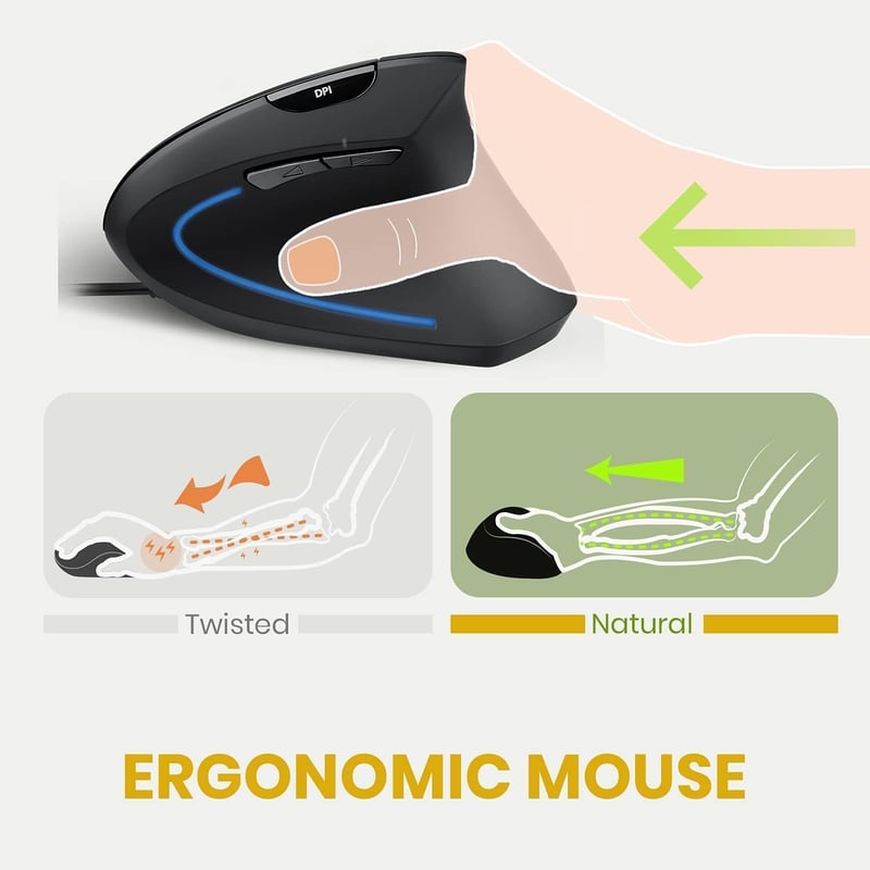 Perixx PERIMICE-513 Ergonomikus Függőleges Egér Jobbkezes 1000/1600 DPI