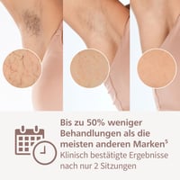 Epilator IPL Philips Lumea Seria 9000 BRI957/00 - cu 4 capete pentru corp și față, fără fir, alternativă la laser, 2 ani de piele fină 4