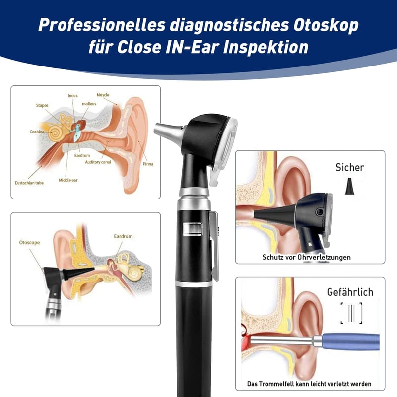 SCIAN Professzionális Otoszkóp Fénnyel, Orvosi Fülvizsgáló Eszköz 3x Nagyítással, Optikai Világítás, 4 Tölcsér, Gyerek Felnőtt Háziállat