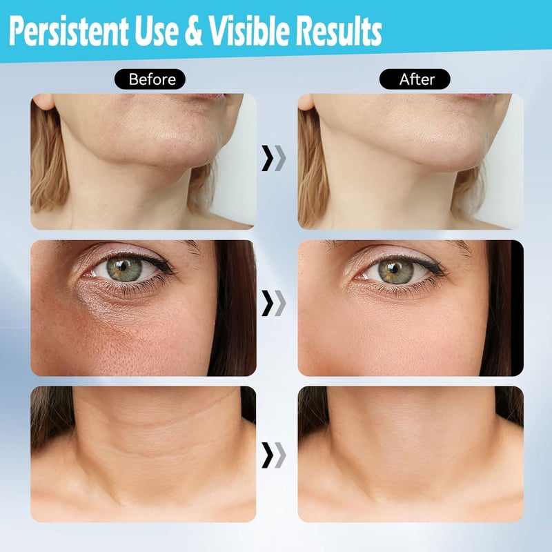 ScriMemo 3D Gua Sha Arcmasszázs Mikroárammal, V-alakú Arclifting Eszköz Ránctalanításhoz