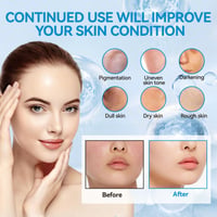 SHOPPGO BB Facial Glow sérum microneedling sada s niacínamidom a peptidmi, zjednocujúca tón pleti, podkladová, hydratačná a proti starnutiu, 10 x 5 ml 3
