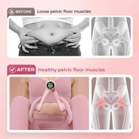 Sunshine smile Comb Trainer Intelligens Számlálóval Csípő és Lábedzéshez 5
