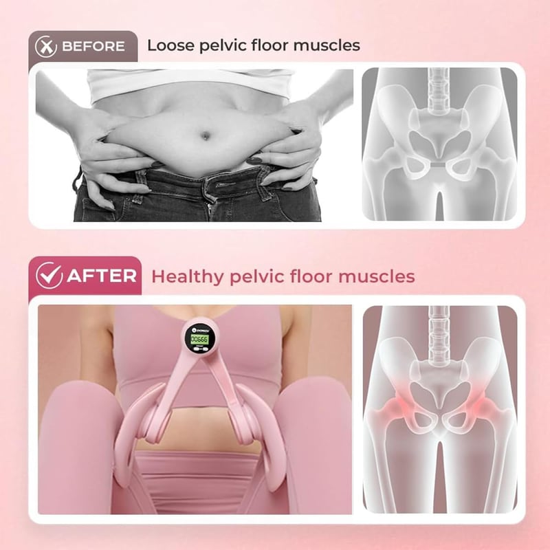 Sunshine smile Comb Trainer Intelligens Számlálóval Csípő és Lábedzéshez