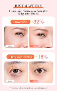 TOUCHBeauty Szemmaszírozó EMS Technológiával - Újratölthető Szemkörnyék Ápoló Melegítő és Vibrációs Funkcióval, Szarkalábak és Karikák Ellen 5
