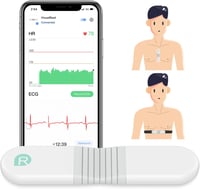 ViATOM VisualBeat Mellkasi Pulzusmérő - Bluetooth, ANT+, EKG Funkcióval, Rezgő Riasztással, 24 Órás Monitorozás, Sportoláshoz, Okostelefonna 1