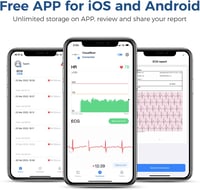 ViATOM VisualBeat Mellkasi Pulzusmérő - Bluetooth, ANT+, EKG Funkcióval, Rezgő Riasztással, 24 Órás Monitorozás, Sportoláshoz, Okostelefonna 4