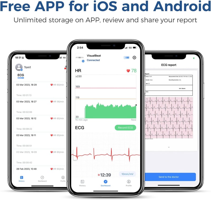 ViATOM VisualBeat Mellkasi Pulzusmérő - Bluetooth, ANT+, EKG Funkcióval, Rezgő Riasztással, 24 Órás Monitorozás, Sportoláshoz, Okostelefonna