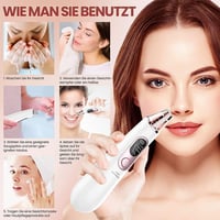 Vinmall Pormosó Blackhead Eltávolító 4 Fej Vákuum Tisztító Készülék 5