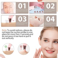 Vinmall Pórustisztító Vákuum Blackhead Eltávolító Kék Fénnyel Akné Elleni Készülék 5