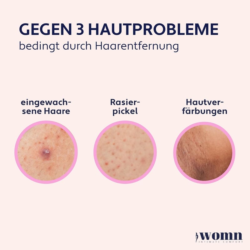 womn Intim Komfort Beépült Szőr Szérum 50ml - Borotvapattanás és Pigmentfoltok Ellen