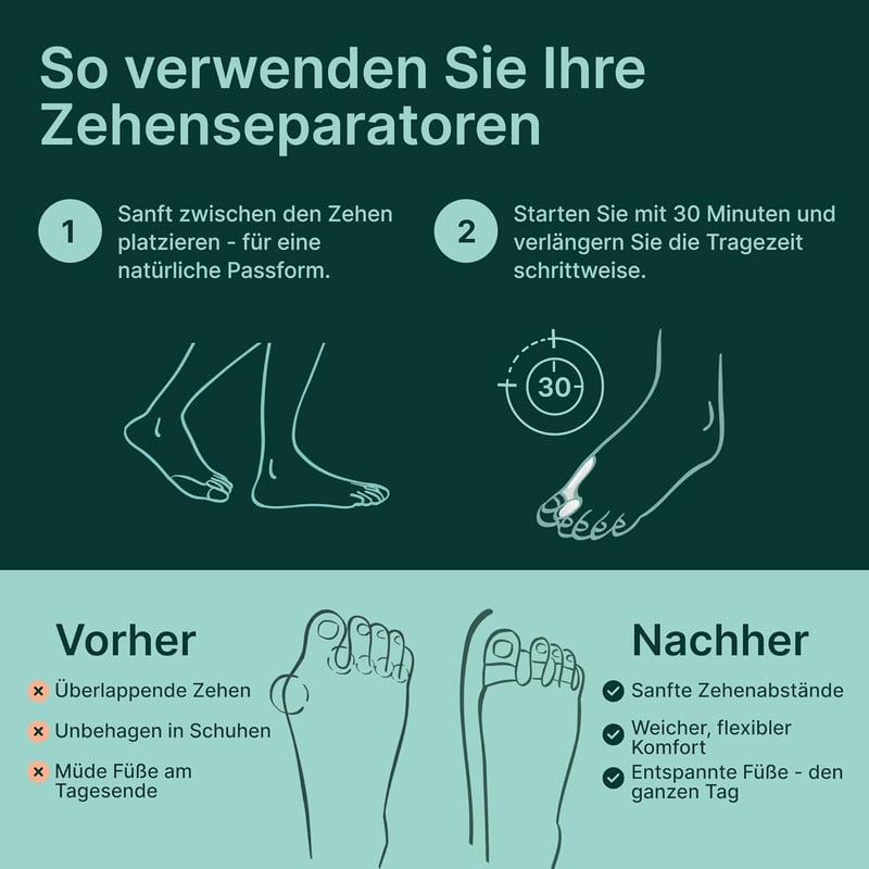 Yogamedic 4 darabos lábujj szeparátor szett hallux valgus kezeléshez