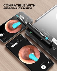 Yumika Fülvizsgáló Otoszkóp Kamera 1080P HD 6 LED-del iOS és Android Okostelefonhoz Fültisztító Endoszkóp 6
